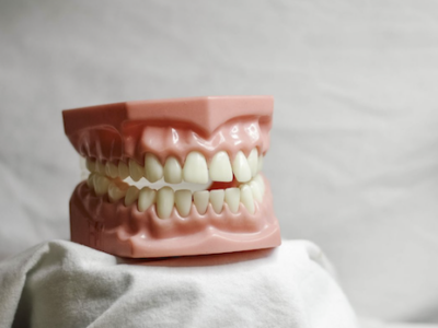 El Centre Dental Francesc Macià explica los consejos para cuidar los grills dentales