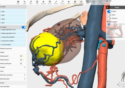 La integración de la IA en modelos 3D permitirá detectar anomalías congénitas en niños, según expertos del Congreso de la SECP