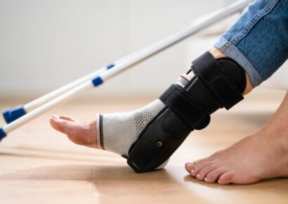 Los esguinces de tobillo mal recuperados pueden provocar inestabilidad y desgaste articular 