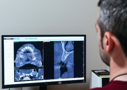 IOCantábrico analiza el papel de los implantes dentales en Gijón como solución avanzada para recuperar la sonrisa