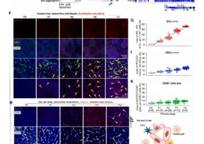 Un estudio publicado en Cell identifica ROCK2 como nueva diana terapéutica para la fibrosis hepática con el apoyo de Cloud-Clone